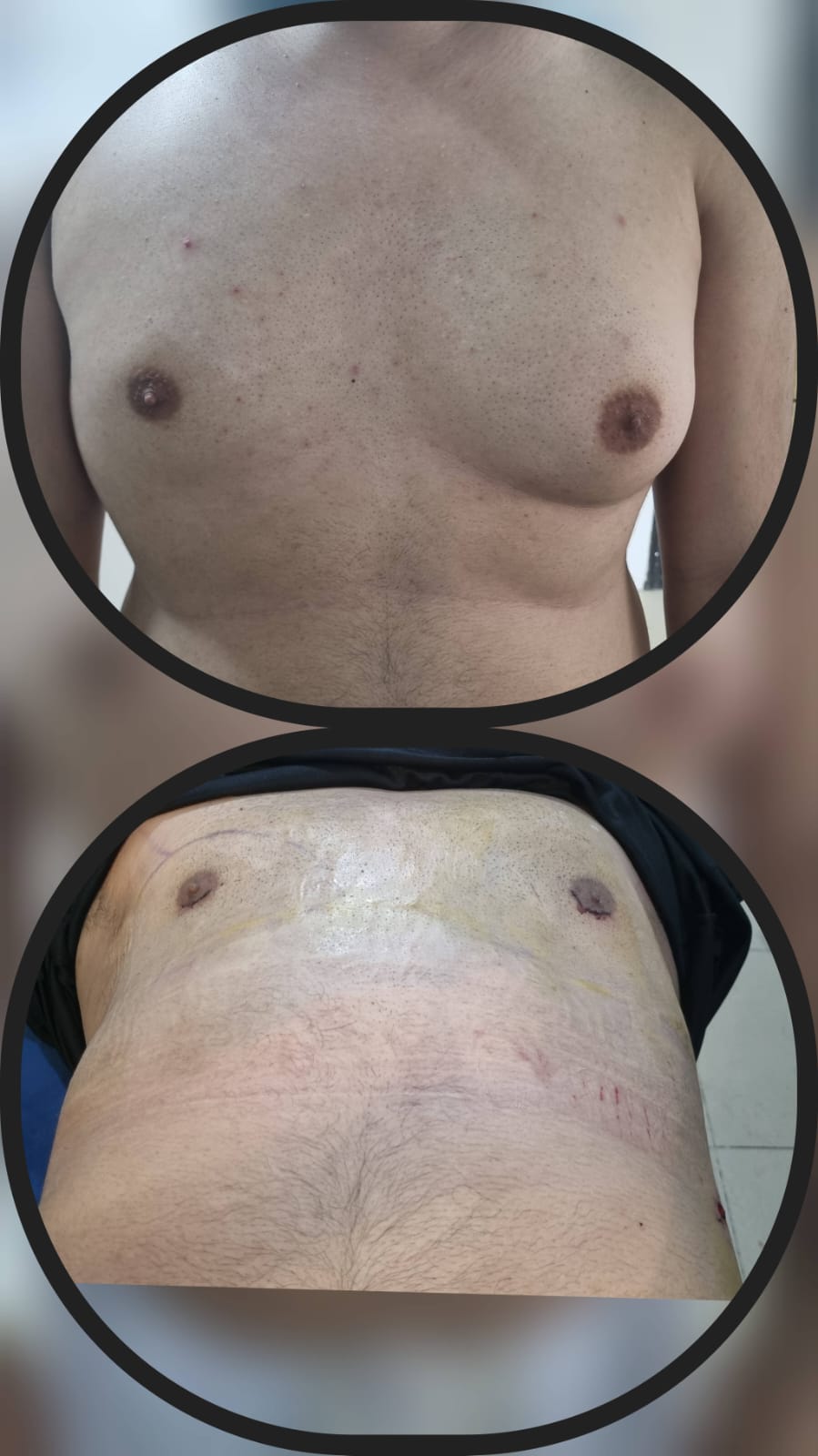 Before & After 44